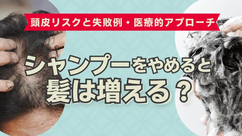 シャンプーをやめると髪が増える？頭皮リスクと医学的アプローチの解説アイキャッチ