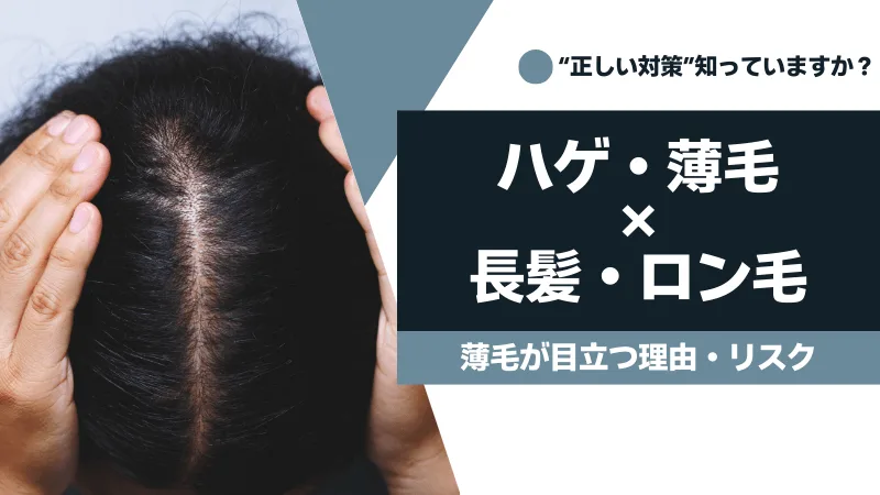 ハゲ・薄毛にロン毛は危険？長髪が目立つ理由・リスクと正しい対策のアイキャッチ画像