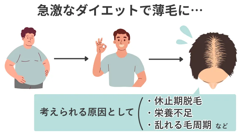 太っていた男性が急激なダイエットで薄毛になった様子を示す画像