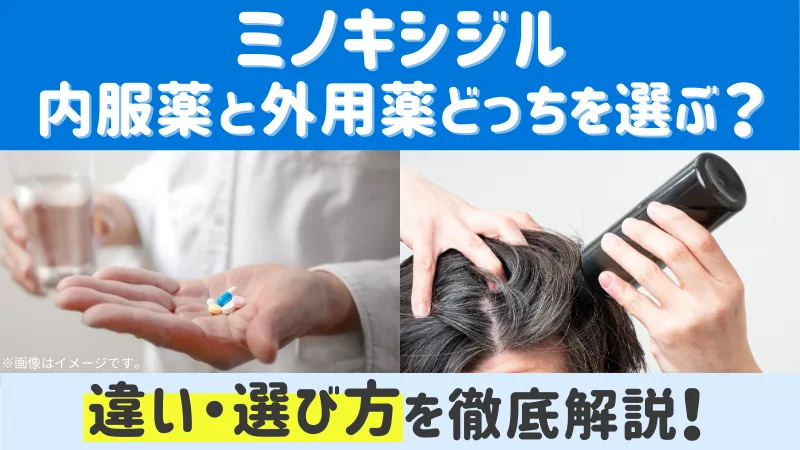 ミノキシジル内服と外用どっちがいい？効果・副作用の違いや選び方のポイントのアイキャッチ画像
