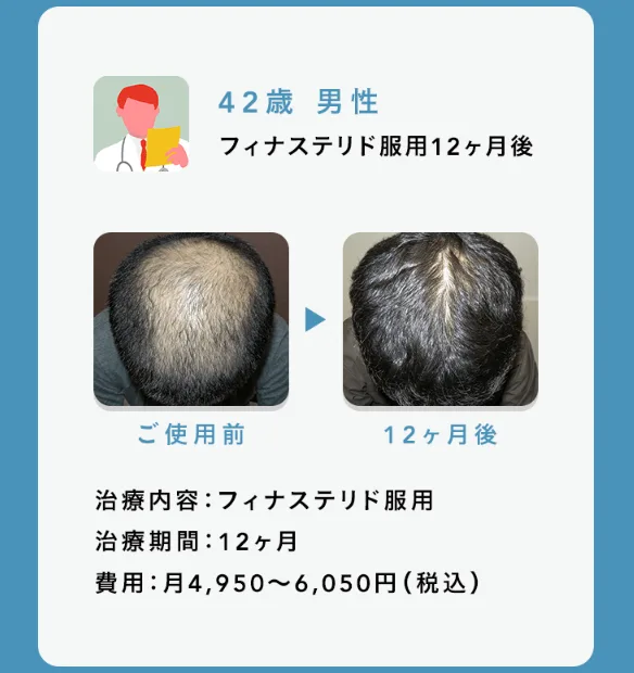 OopsHAIR-効果-ビフォーアフター画像1