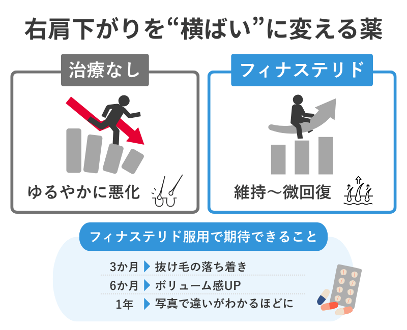 フィナステリドで右肩下がりのAGA進行が横ばいになることを示す比較図