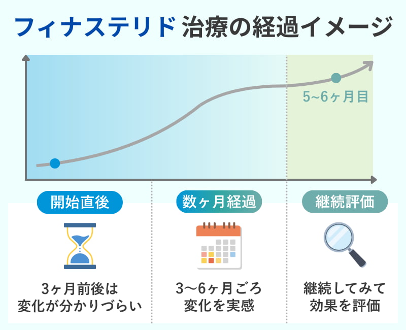 フィナステリド治療で効果を判断するまでの一般的な経過イメージ